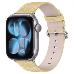 Arany Glimmer Apple Watch szíj